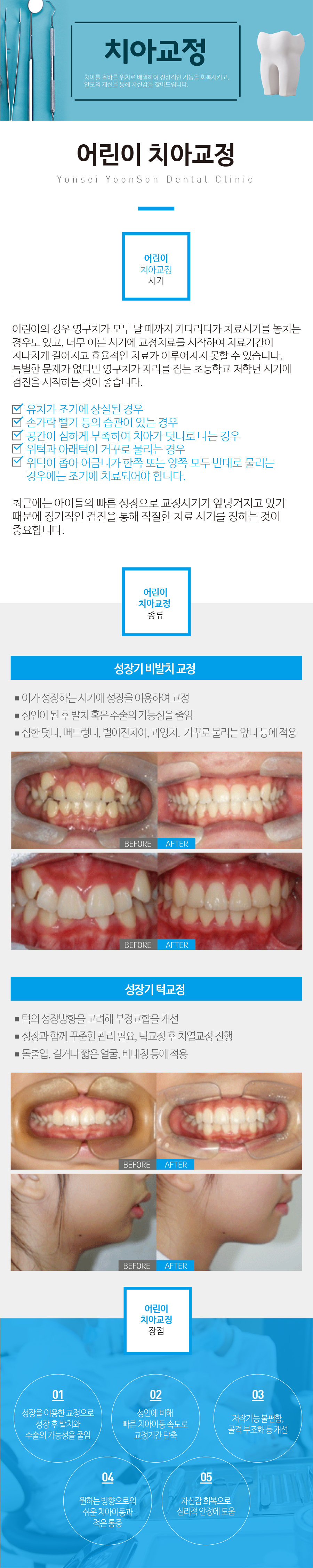 ���ġ�Ʊ���