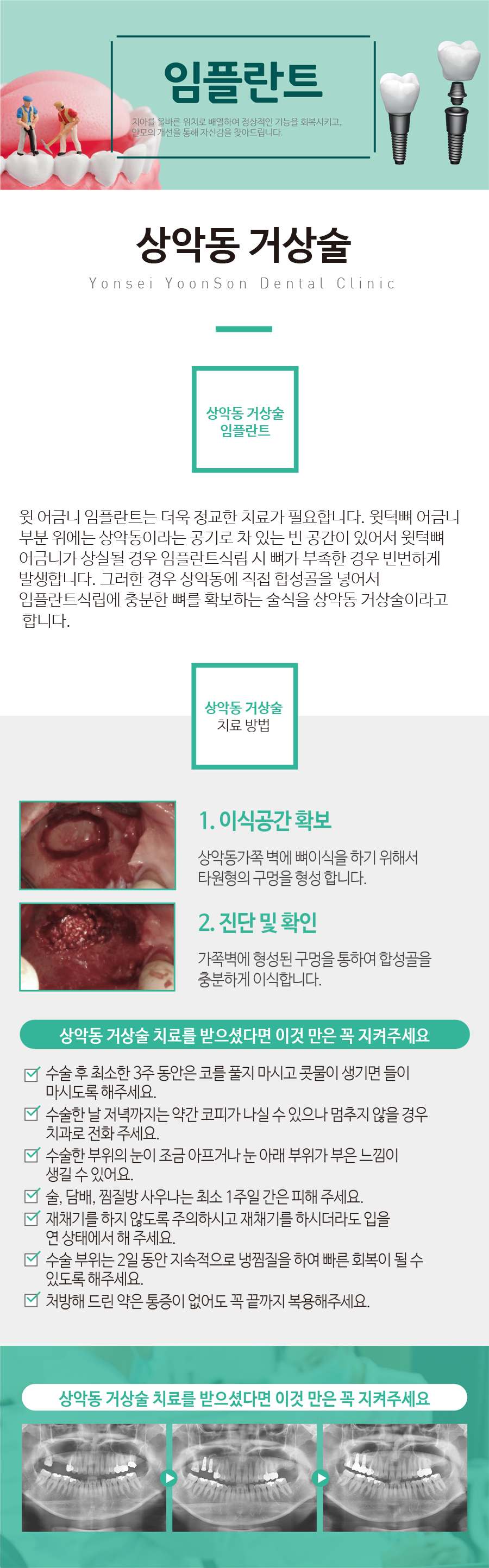 ��ǵ��Ż��