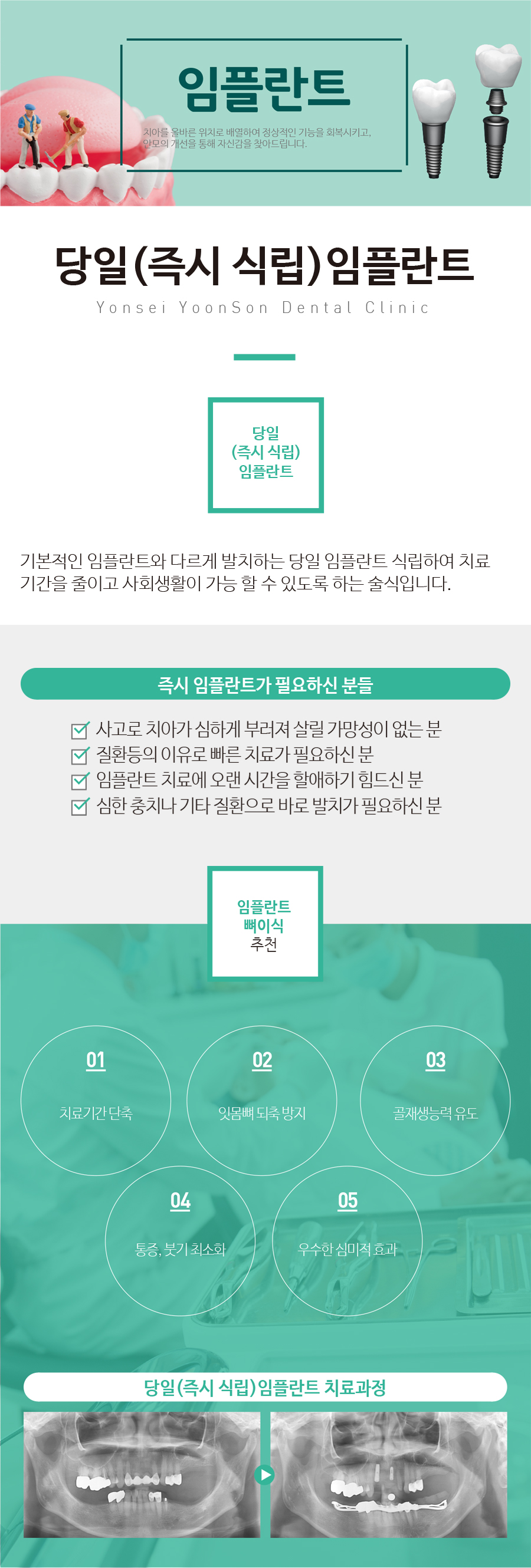 ��ġ������ö�Ʈ