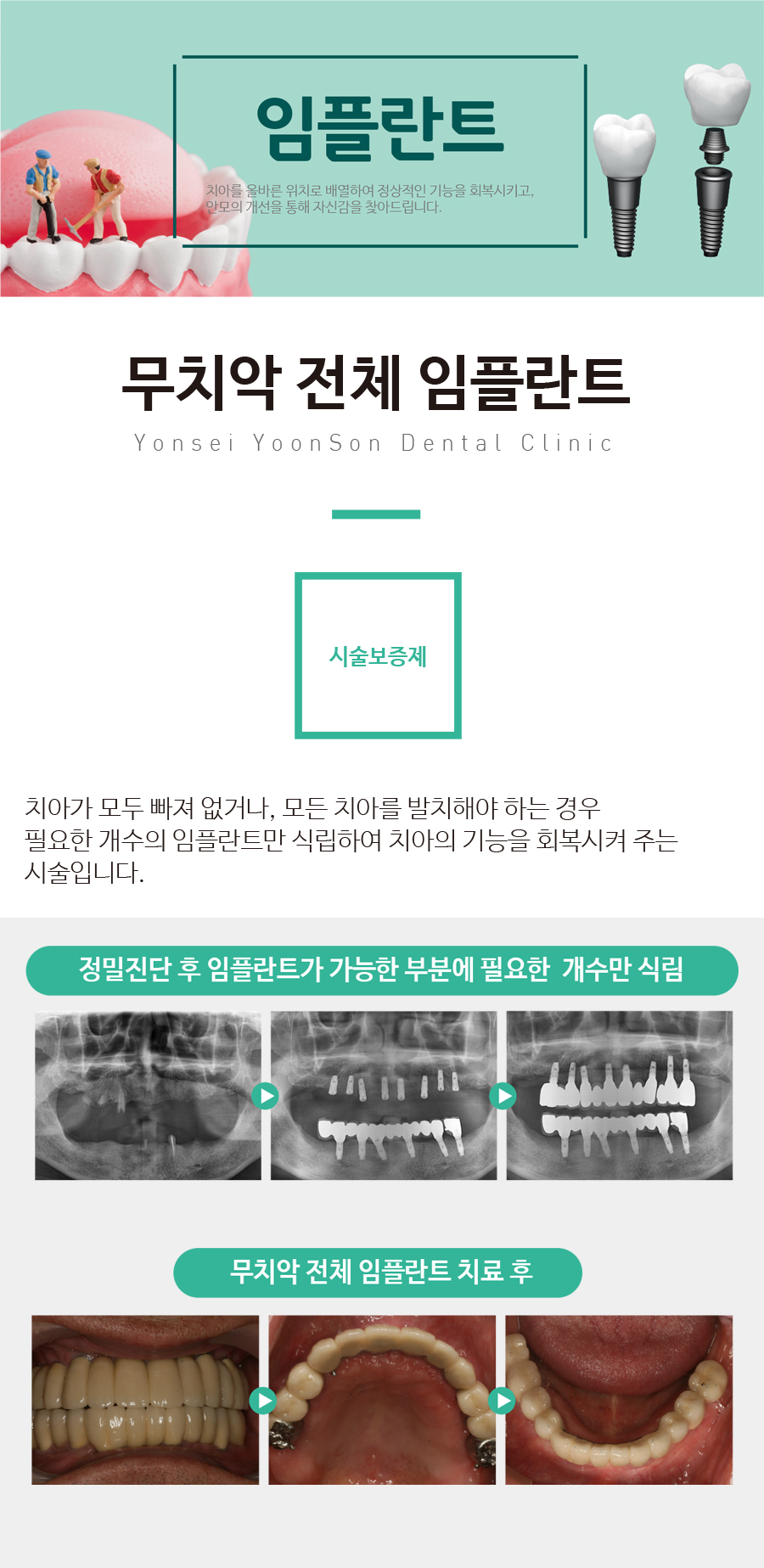 ��ġ����ü���ö�Ʈ