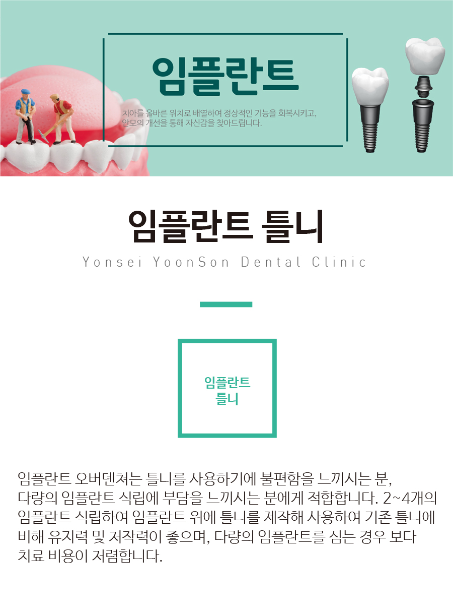 ���ö�ƮƲ��